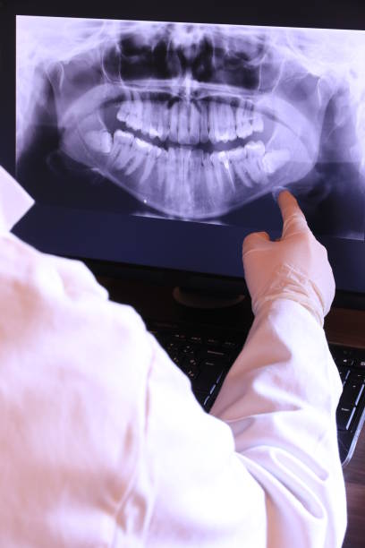 Best Emergency Tooth Extraction in Celina, TN